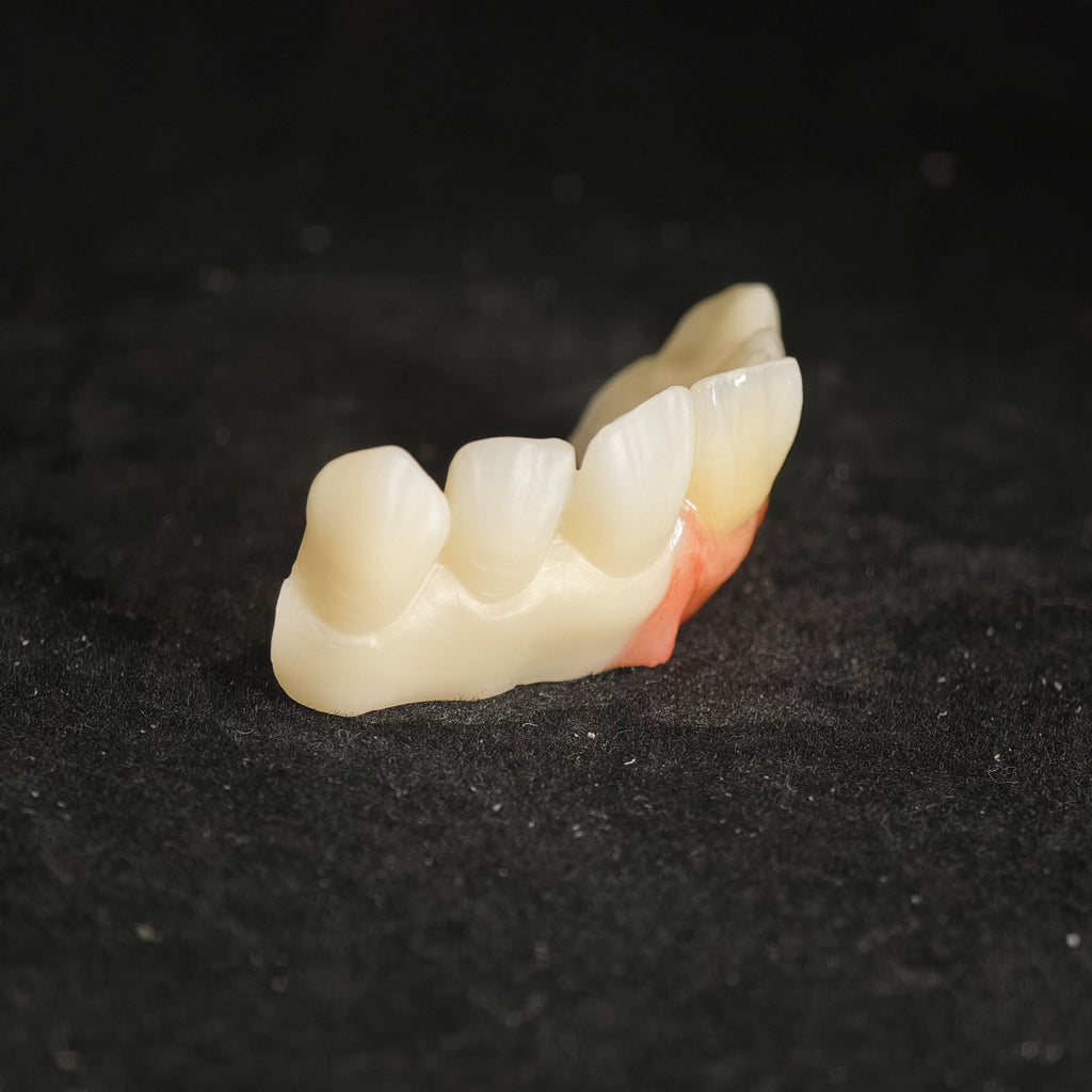Ti-Bar Pure Titanium Metal Frame With Zirconia Bridge