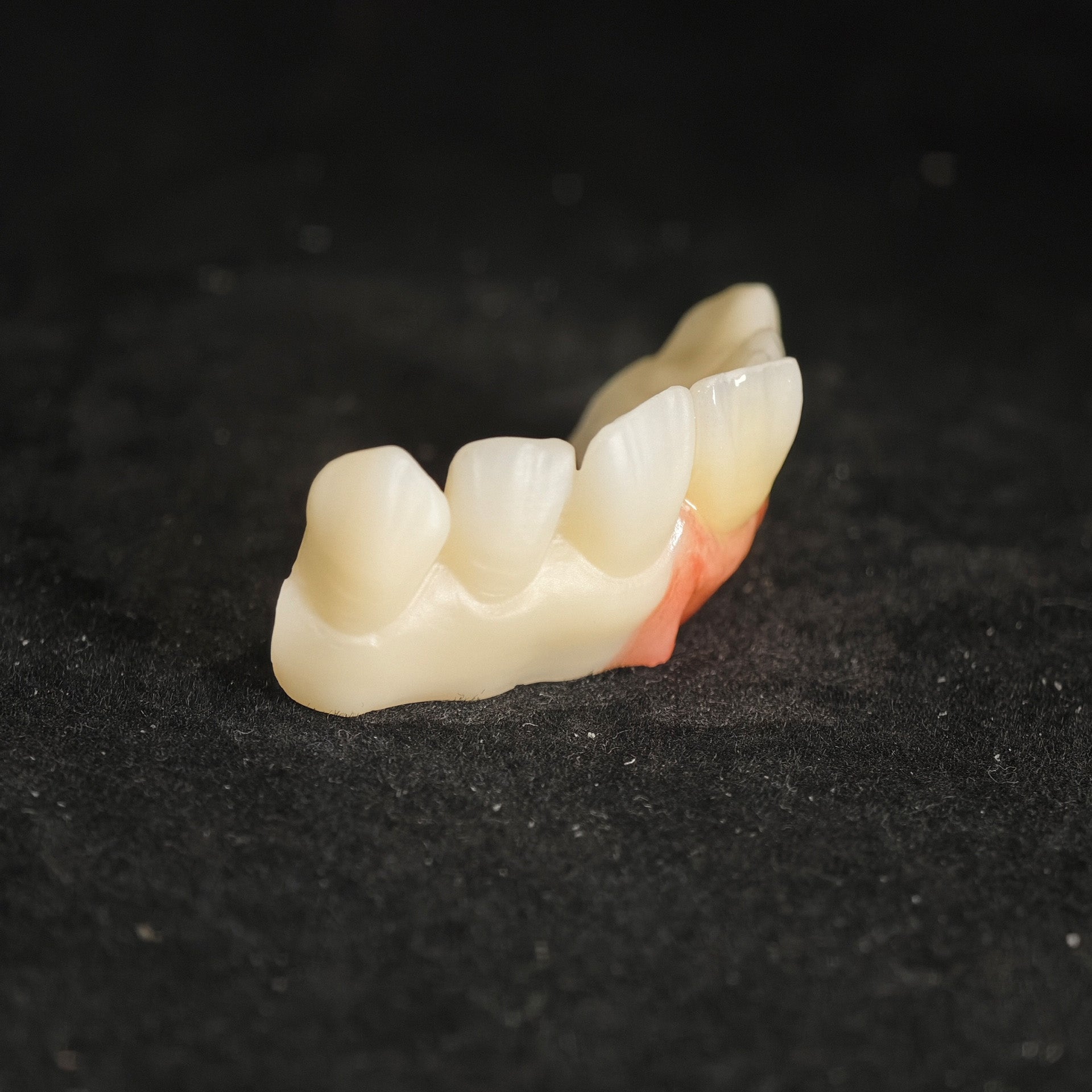 Ti-Bar Pure Titanium Metal Frame With Zirconia Bridge