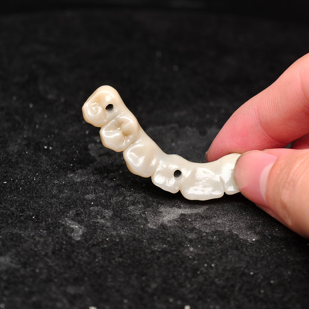 Ti-Bar Pure Titanium Metal Frame With Zirconia Bridge Implant