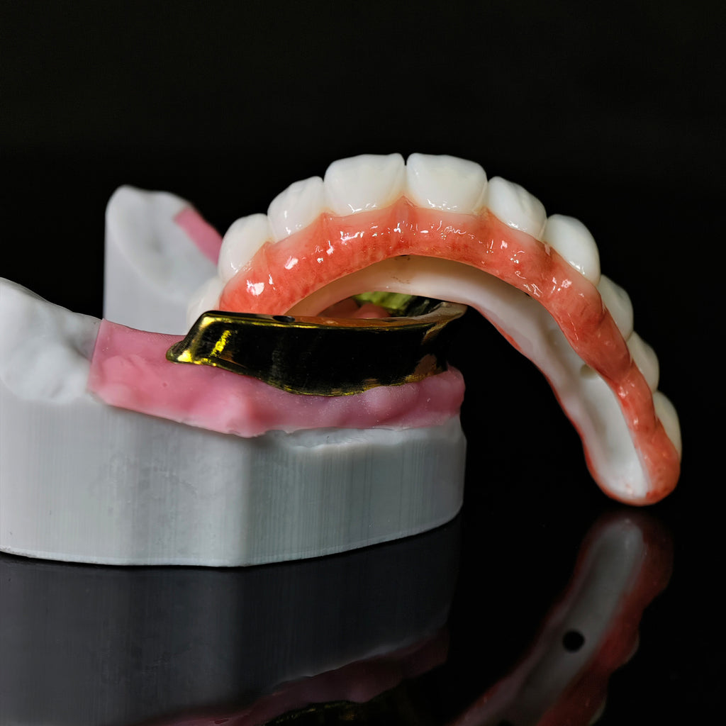 Ti-Bar Titanium Nitride Metal Frame With Zirconia Bridge For Full Arch Restoration