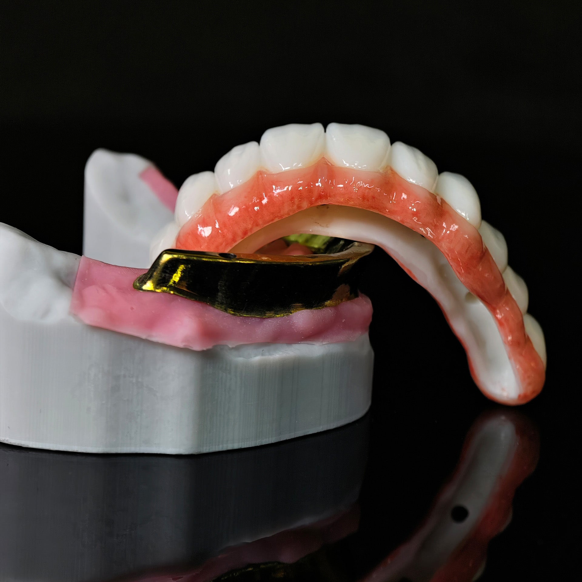 Ti-Bar Titanium Nitride Metal Frame With Zirconia Bridge For Full Arch Restoration