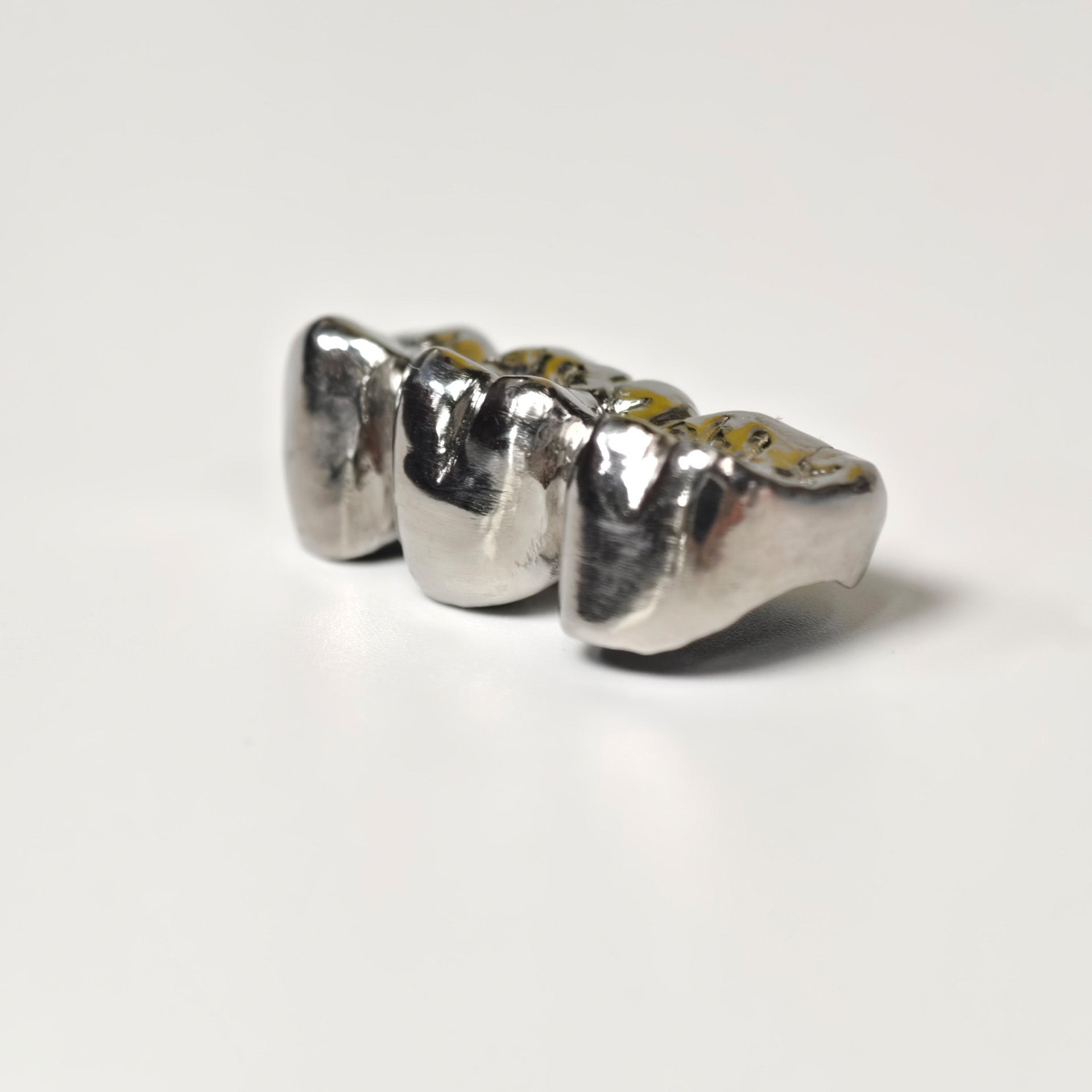 Titanium Crown With Cement Retained