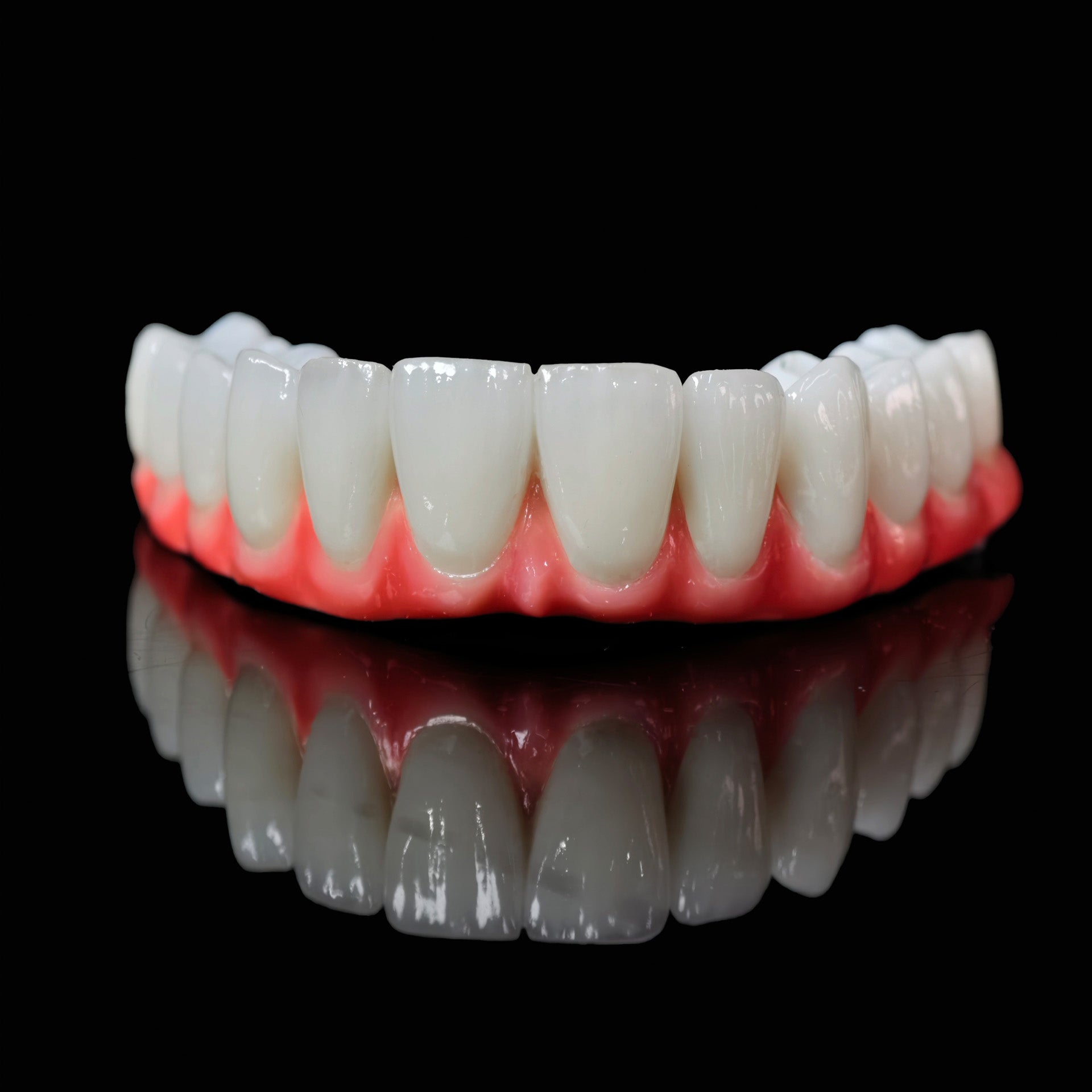 Traditional Malo Bridge With Alloy Framework Covering The Gingiva