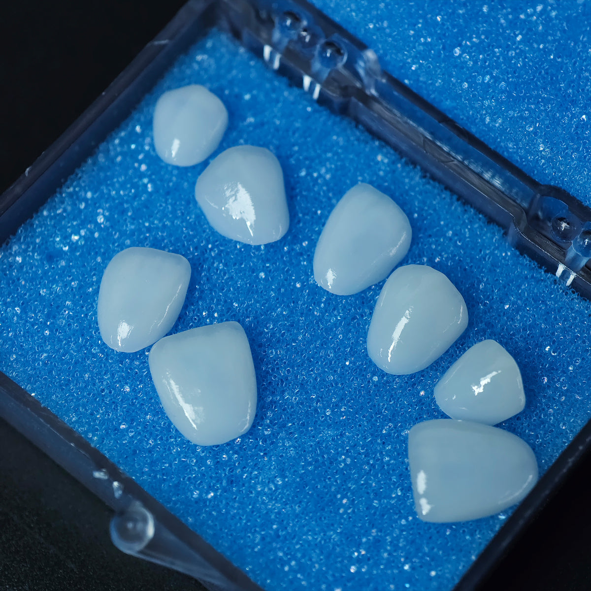 Ultra-Thin Emax Veneer. High Transparency/Translucent, Natural Shade