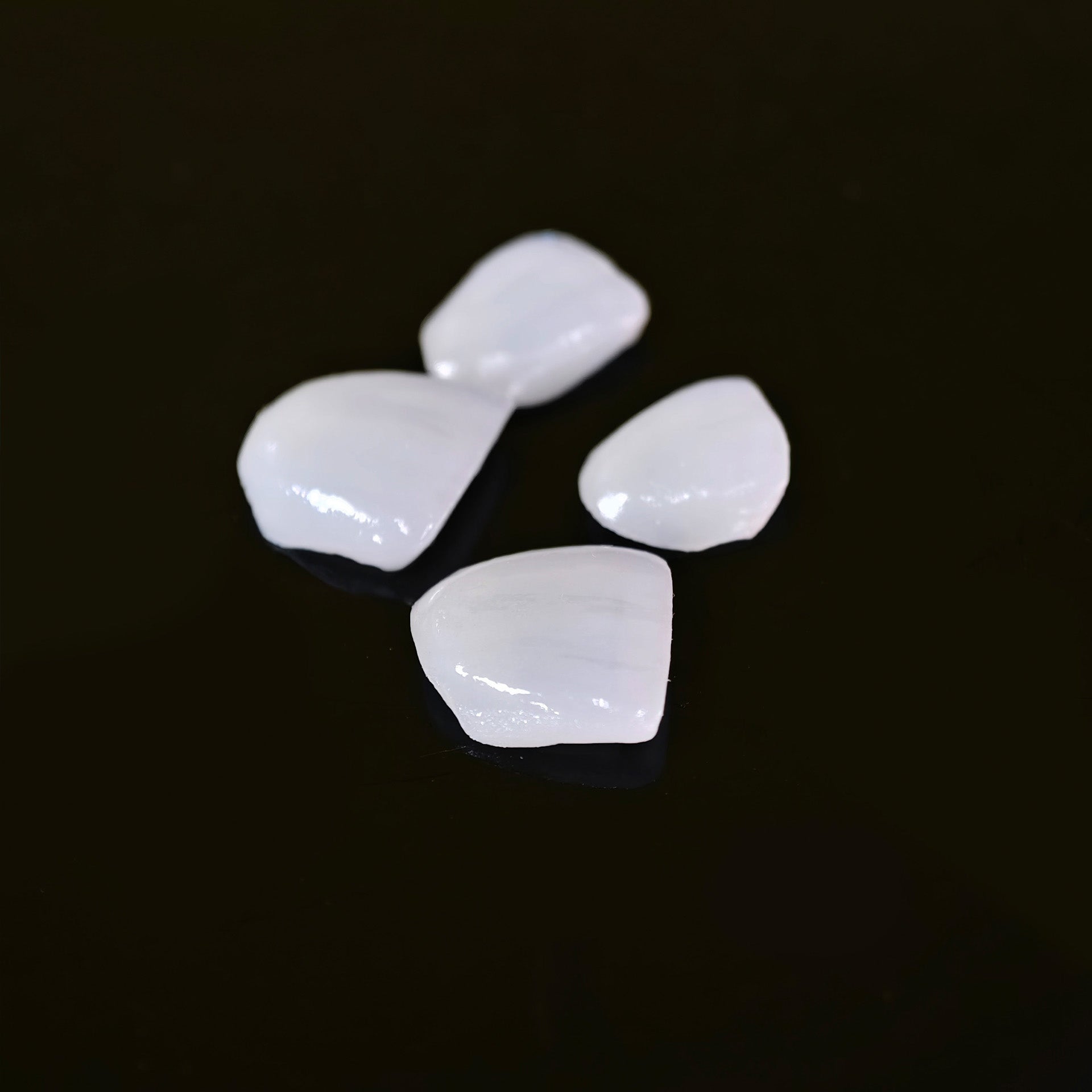 Ultra-Thin Emax Veneer. High Transparency/Translucent, Natural Shade