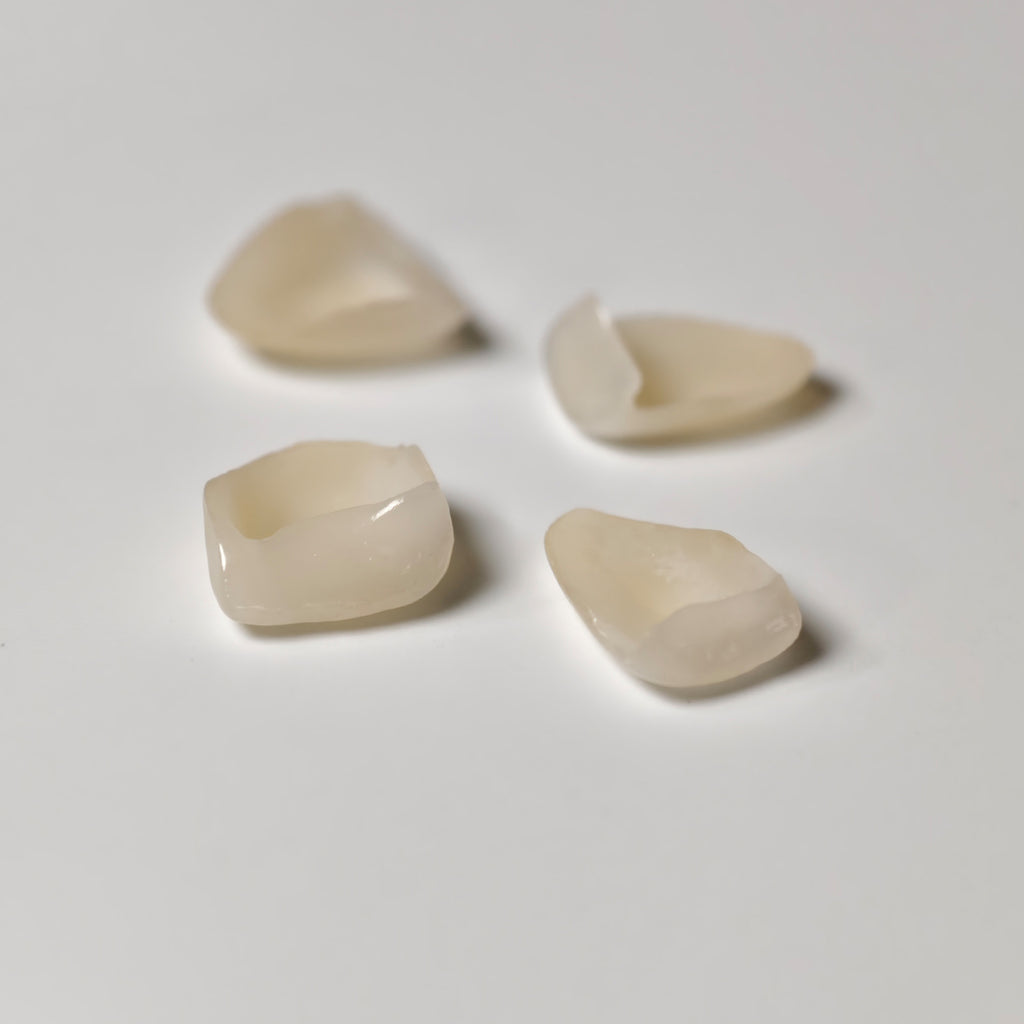 Ultra-Thin Emax Veneer. High Transparency/Translucent, Natural Shade