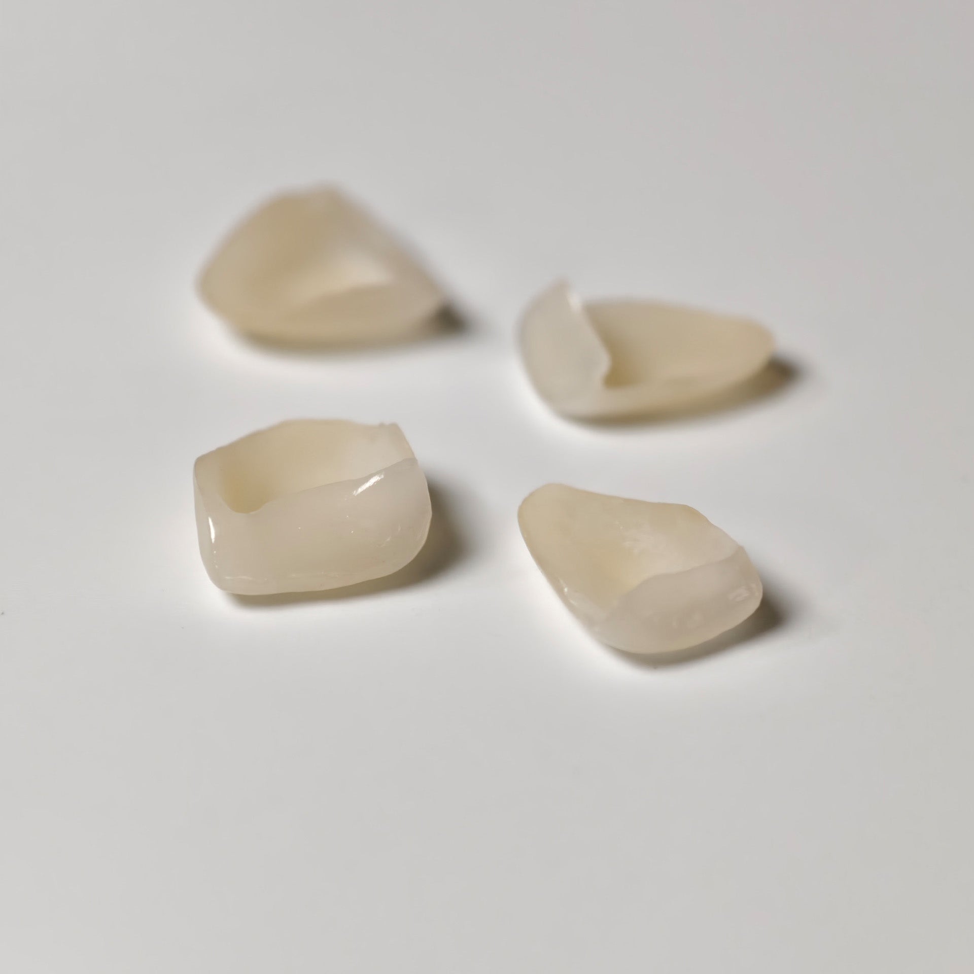 Ultra-Thin Emax Veneer. High Transparency/Translucent, Natural Shade