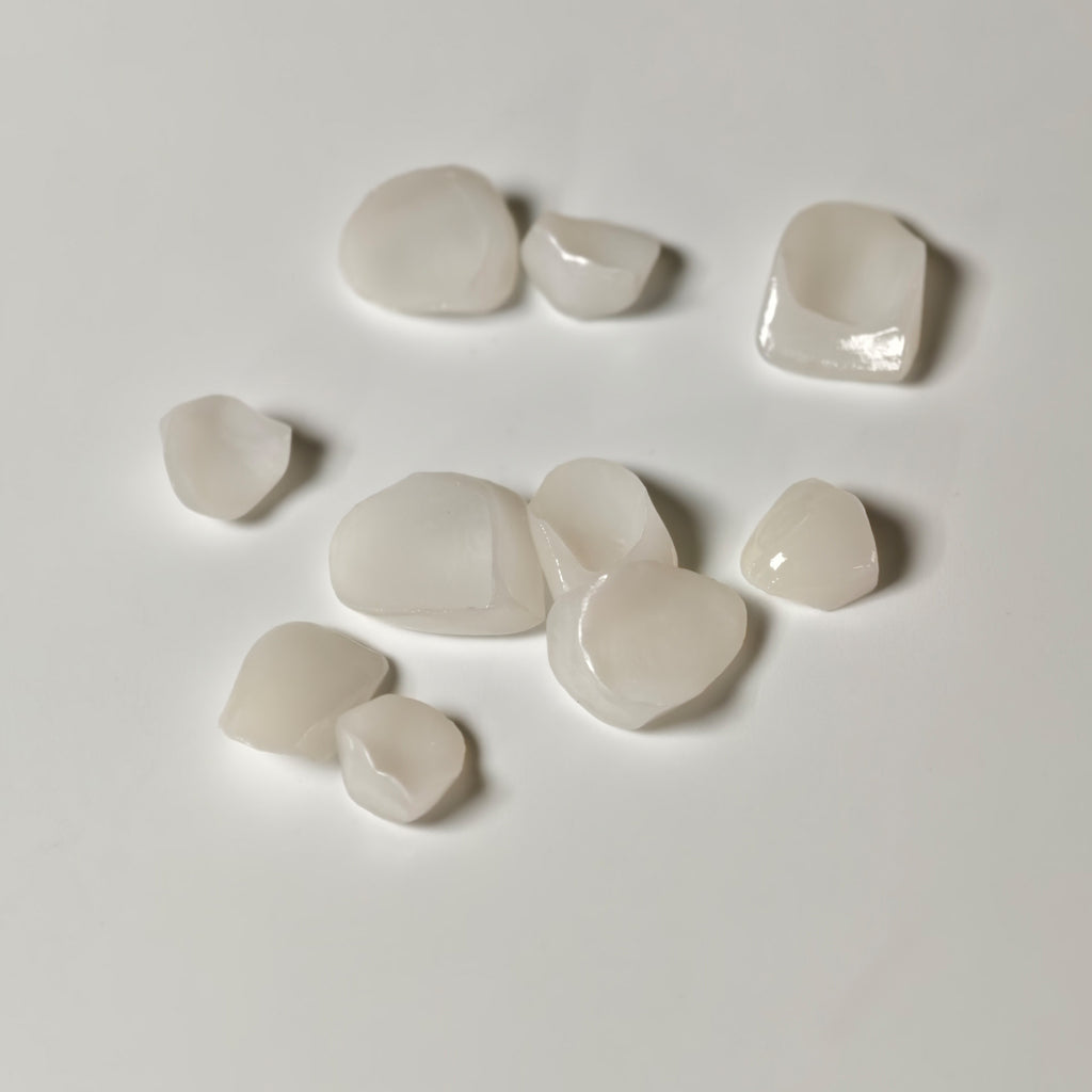 Ultra-Thin Emax Veneer. High Transparency/Translucent, Natural Shade