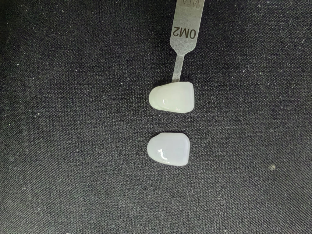 Ultra-Thin Emax Veneer. High Transparency/Translucent, Natural Shade