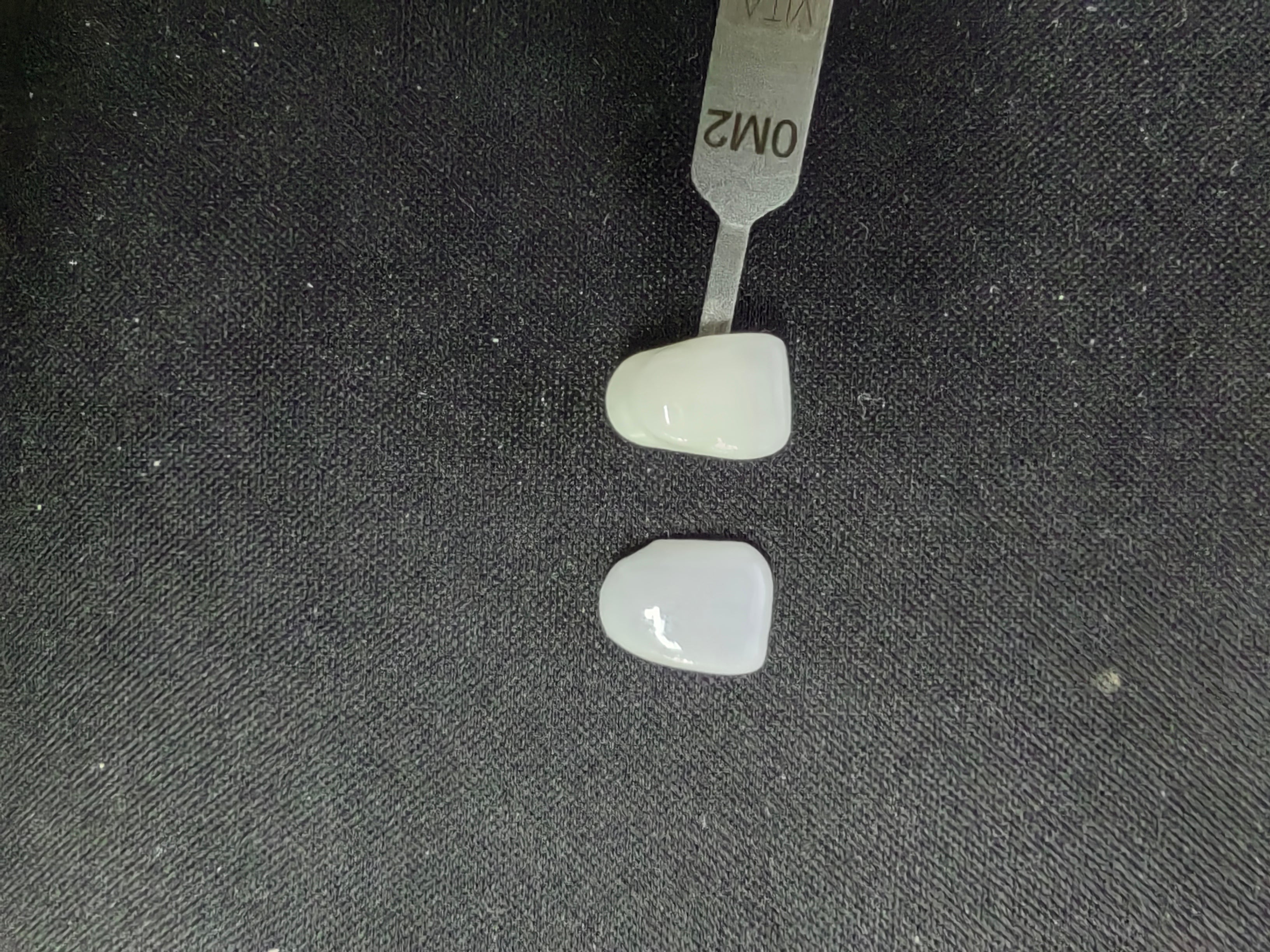 Ultra-Thin Emax Veneer. High Transparency/Translucent, Natural Shade