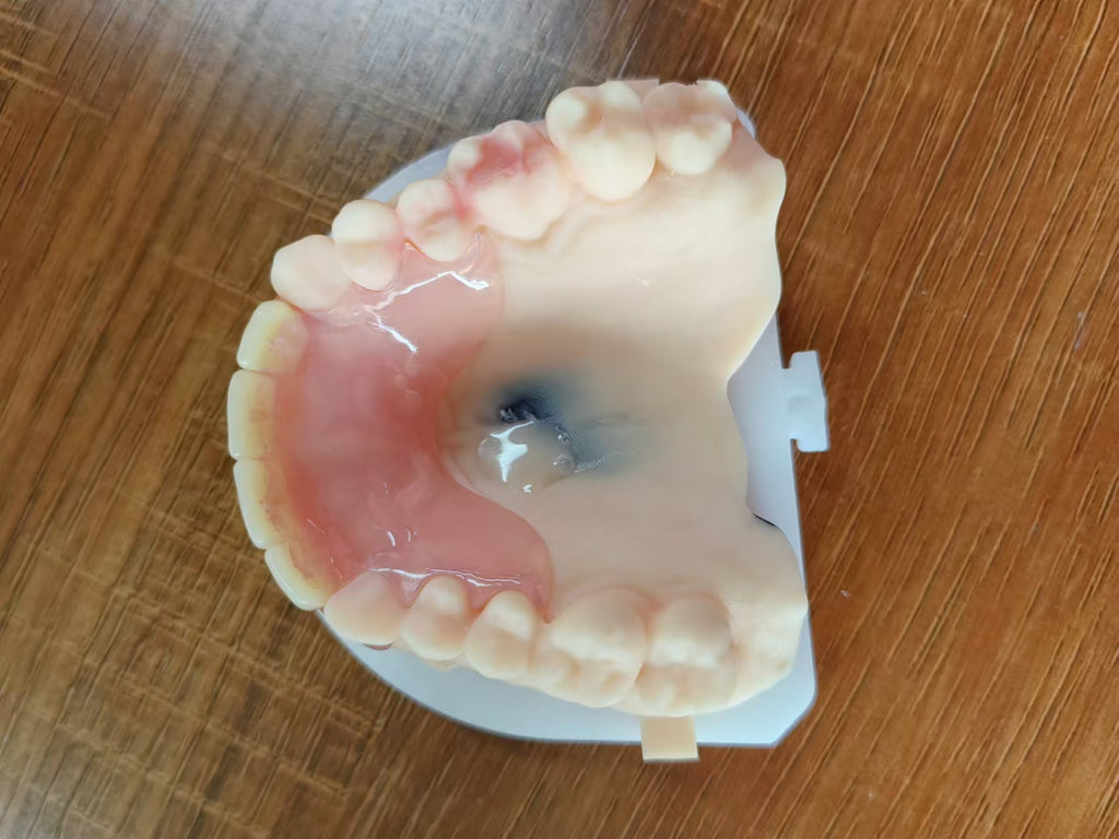 Valplast Denture Beautiful And Elastic Flexible Partial Natural Appearance
