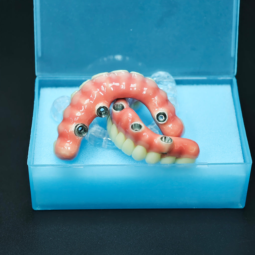 Zirconia-Enamel Hybrid Malo Bridge