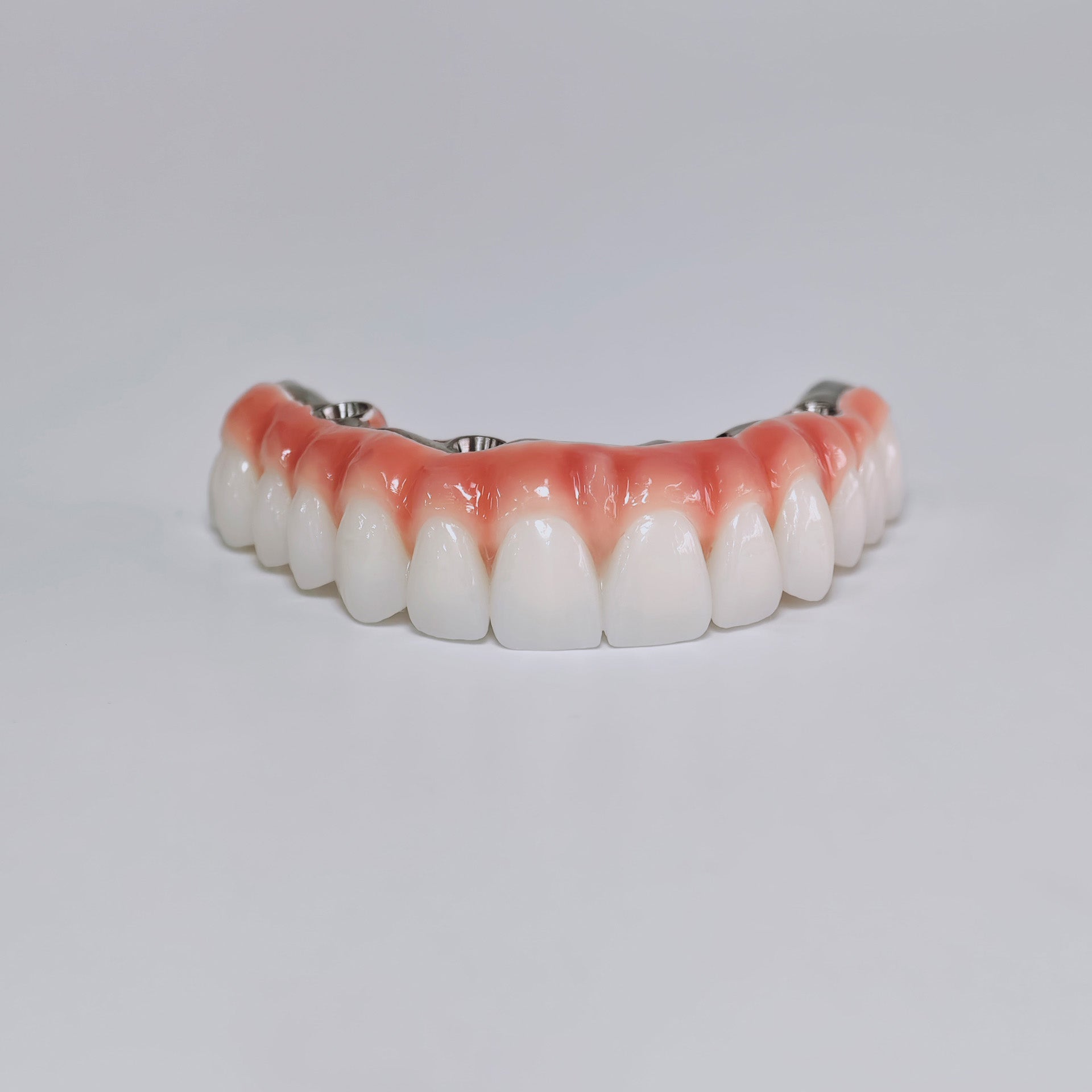 Zirconia-Enamel Hybrid Malo Bridge Aesthetic