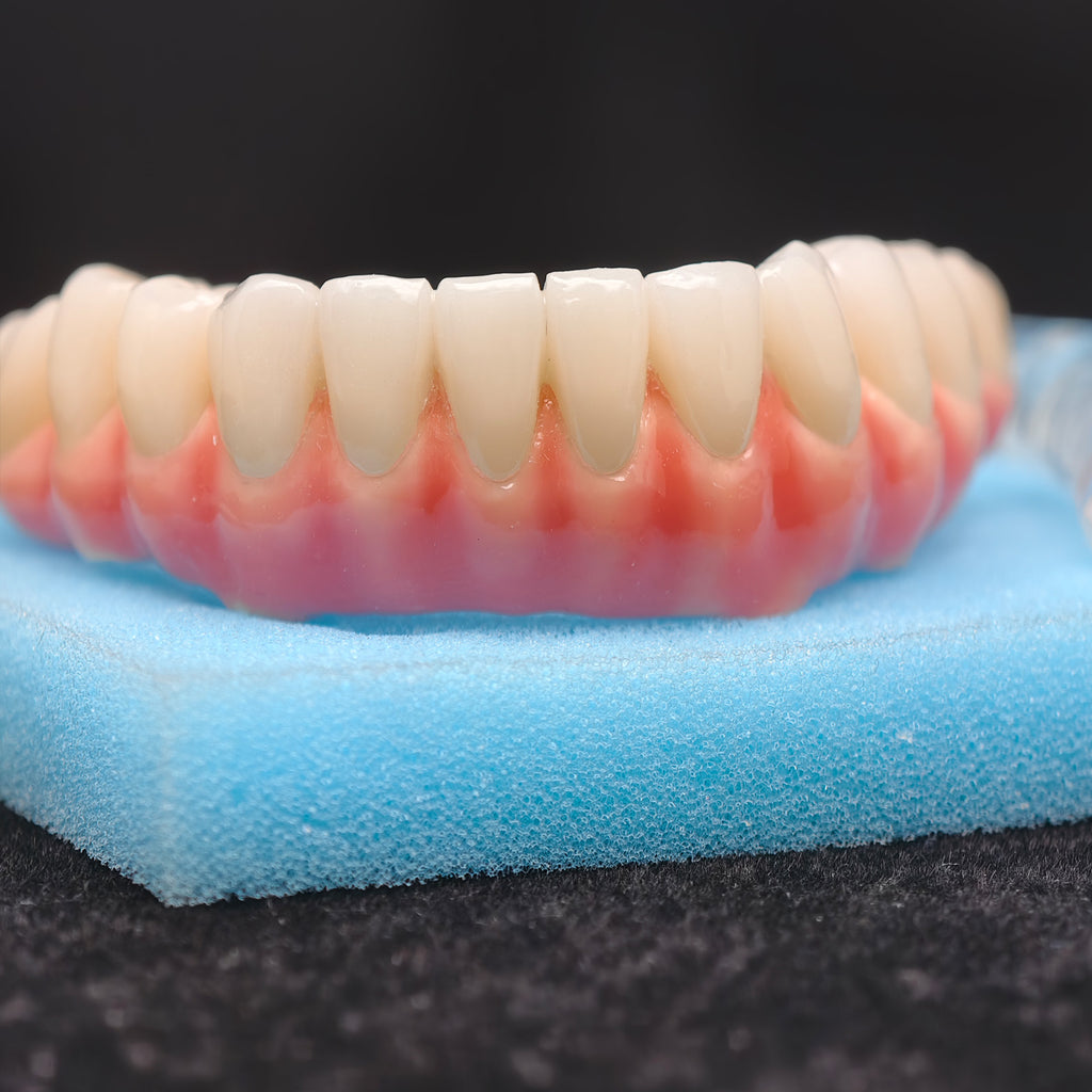 Zirconia-Enamel Hybrid Malo Bridge