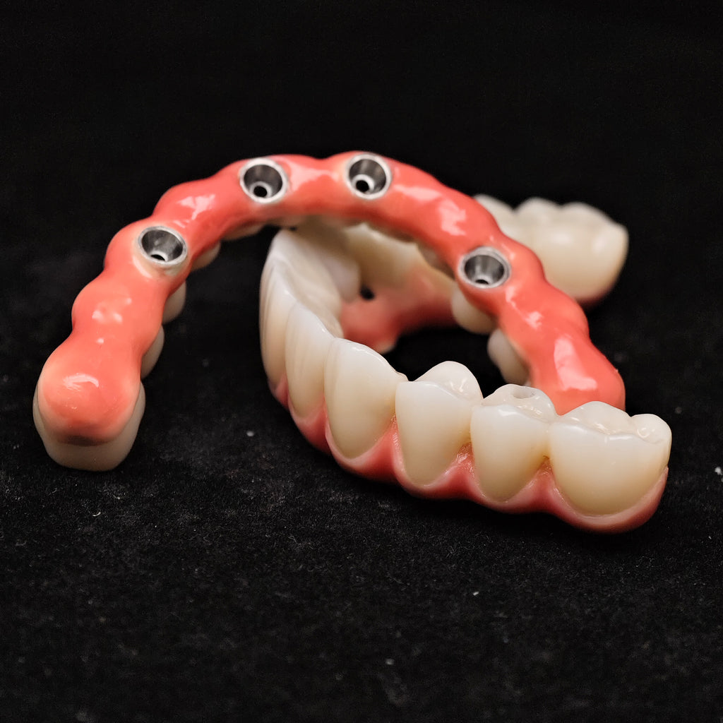 Zirconia-Enamel Hybrid Malo Bridge