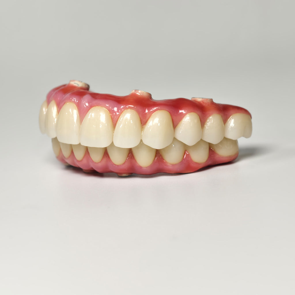 Zirconia-Enamel Hybrid Malo Bridge