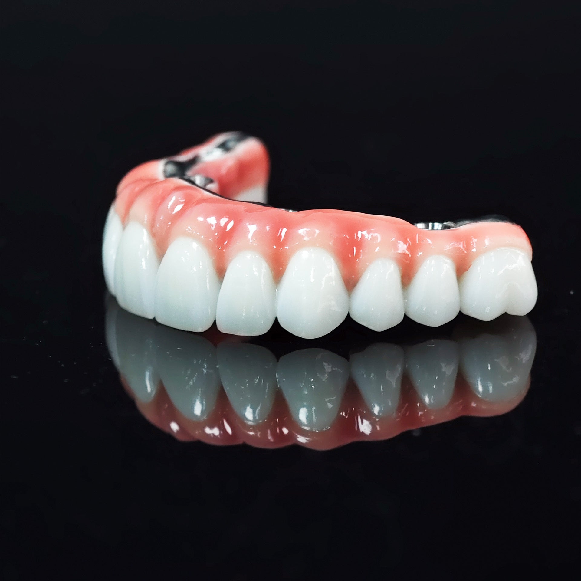 Zirconia-Enamel Hybrid Malo Bridge