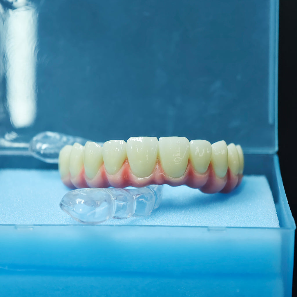 Zirconia-Enamel Hybrid Malo Bridge