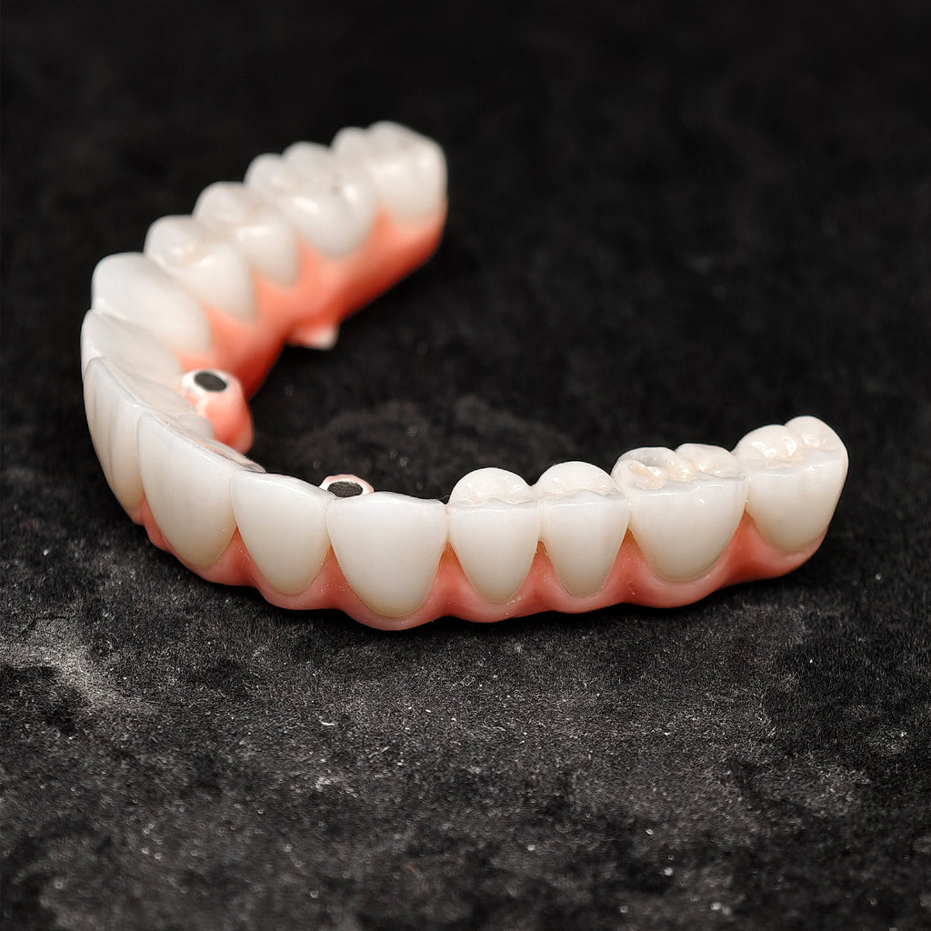 Zirconia-Enamel Hybrid Malo Bridge