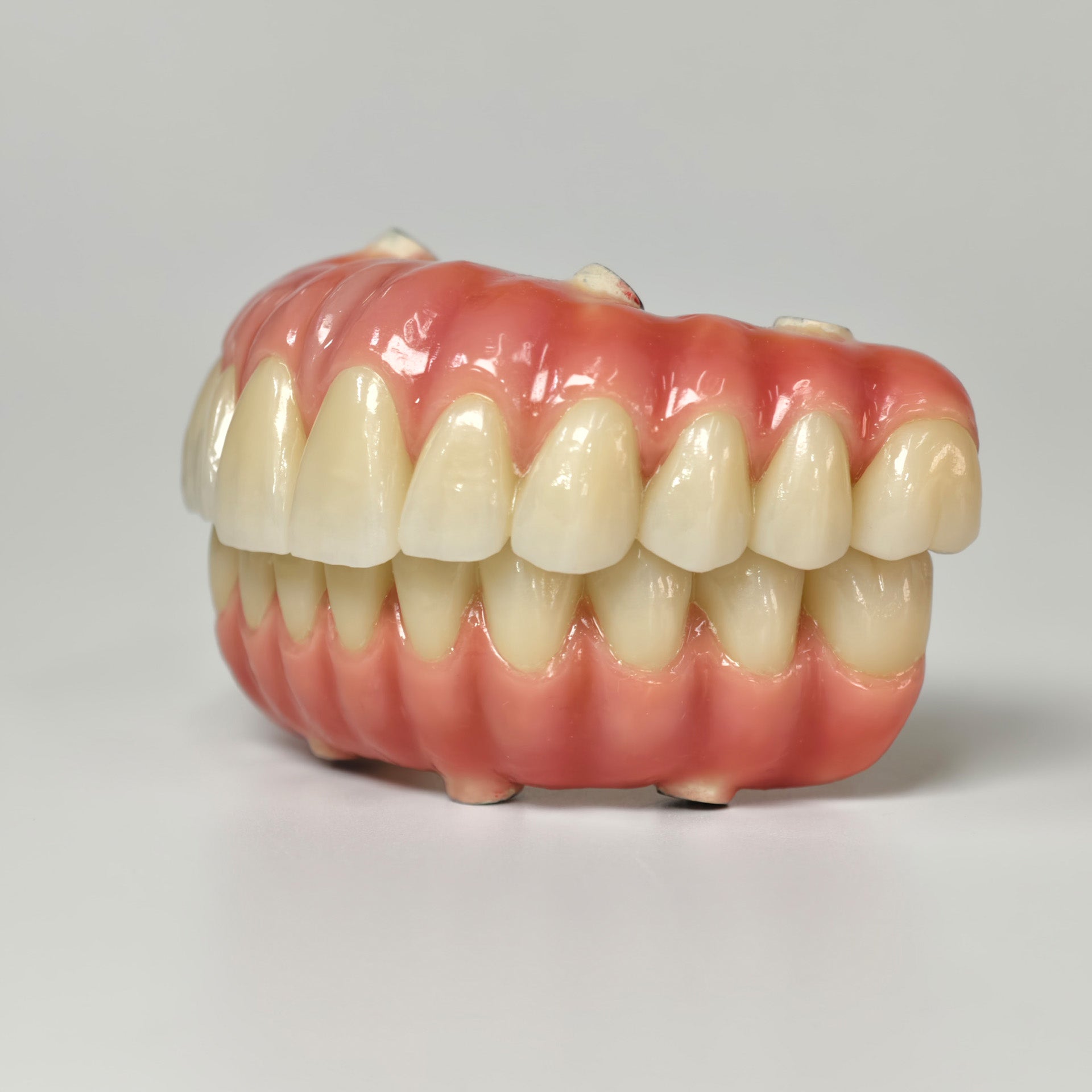 Zirconia-Enamel Hybrid Malo Bridge