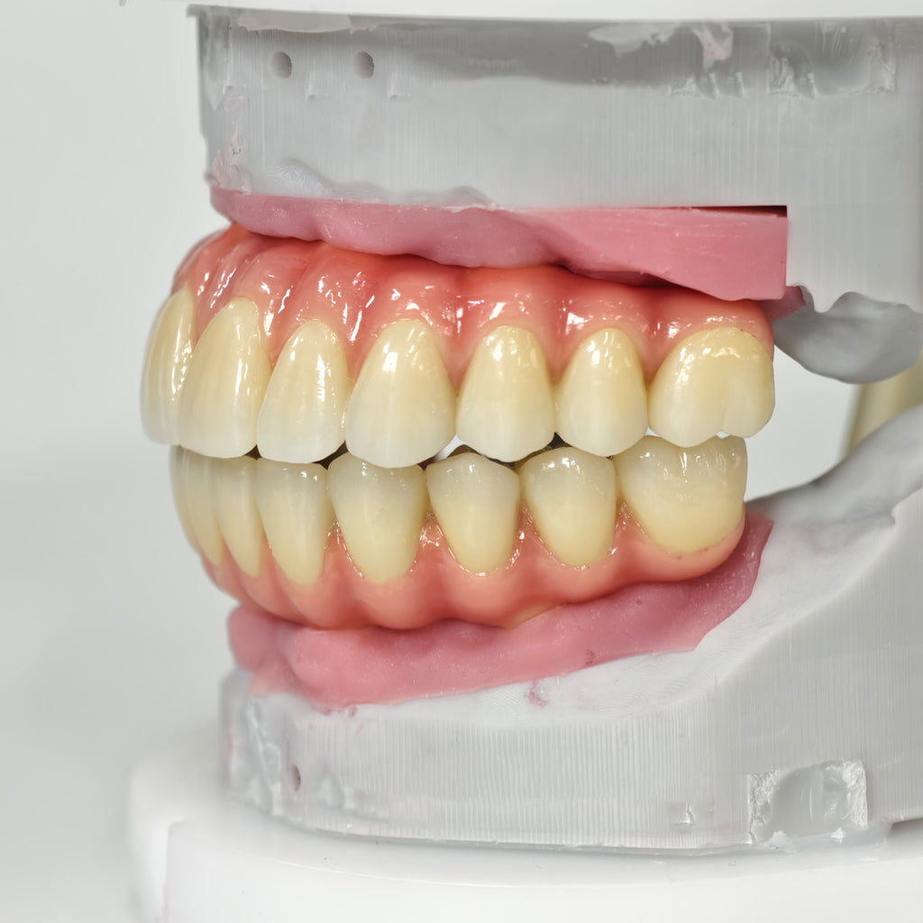Zirconia-Enamel Hybrid Malo Bridge