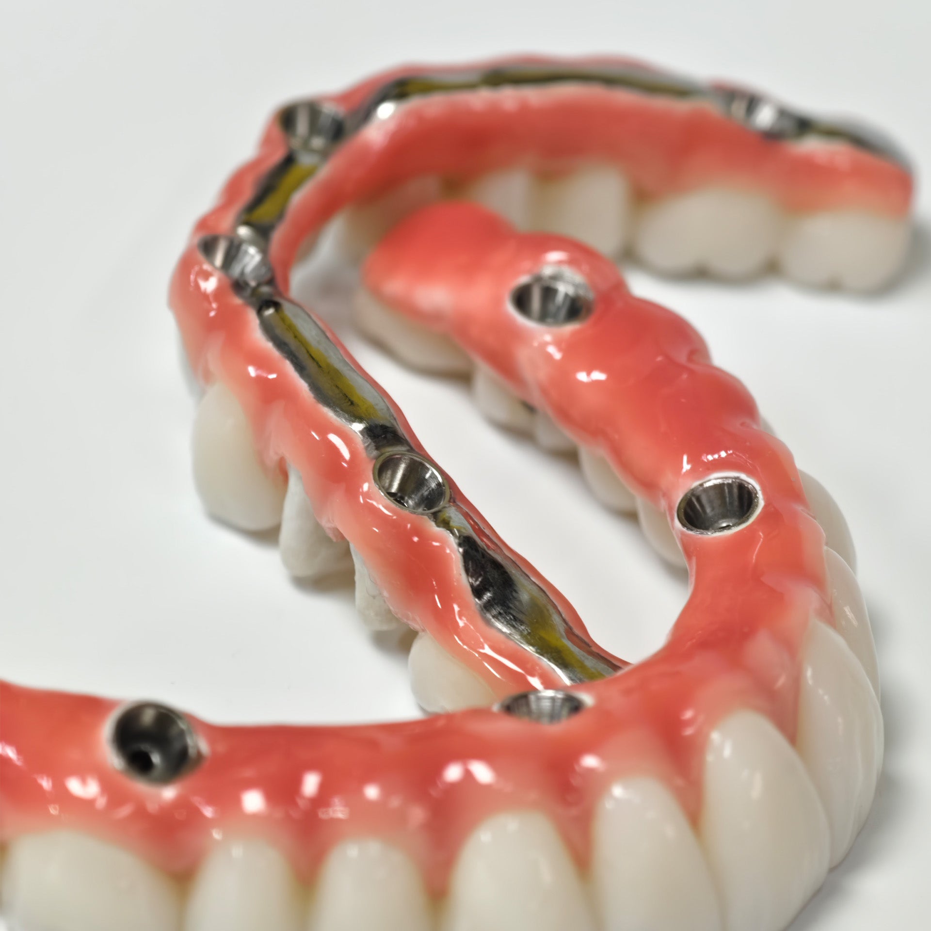 Zirconia-Enamel Hybrid Malo Bridge