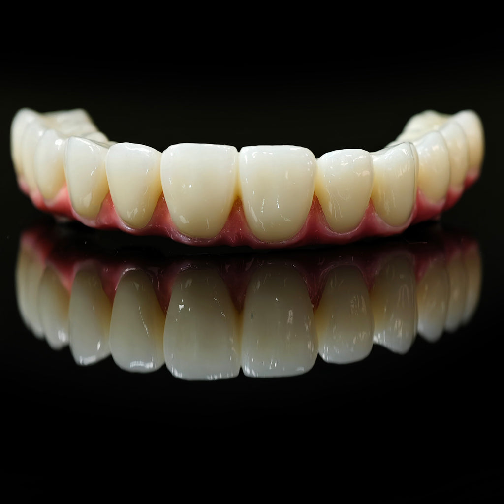 Zirconia-Enamel Hybrid Malo Bridge