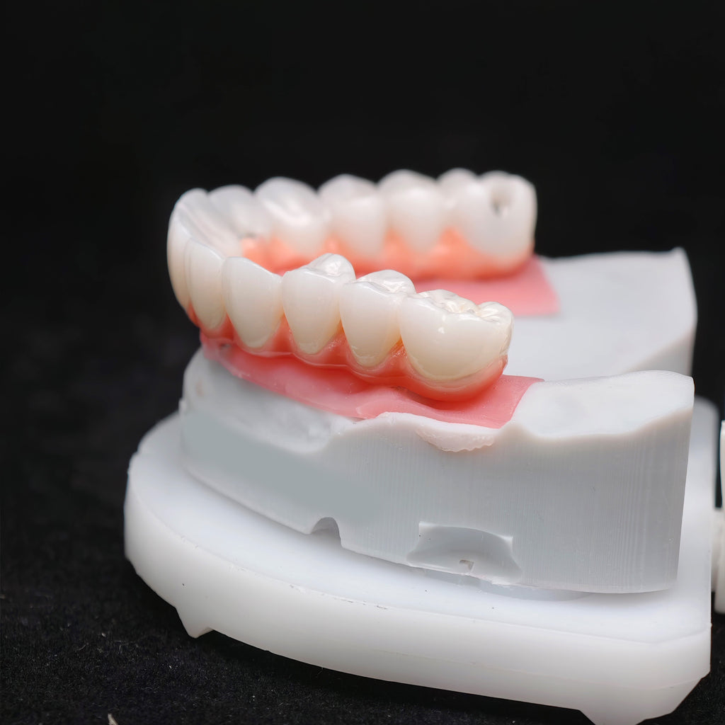 Zirconia-Enamel Hybrid Malo Bridge