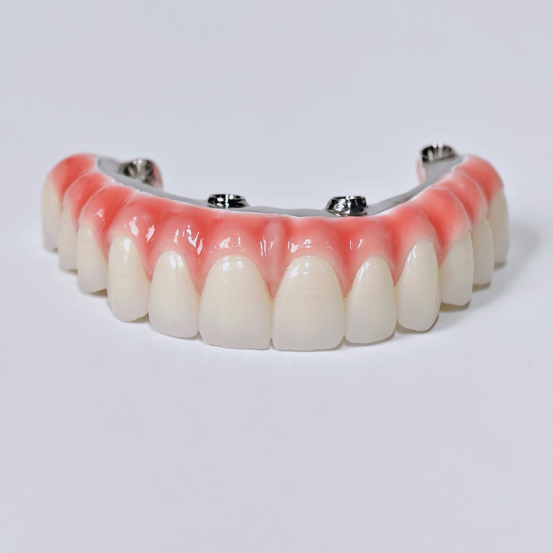 Zirconia-Enamel Hybrid Malo Bridge