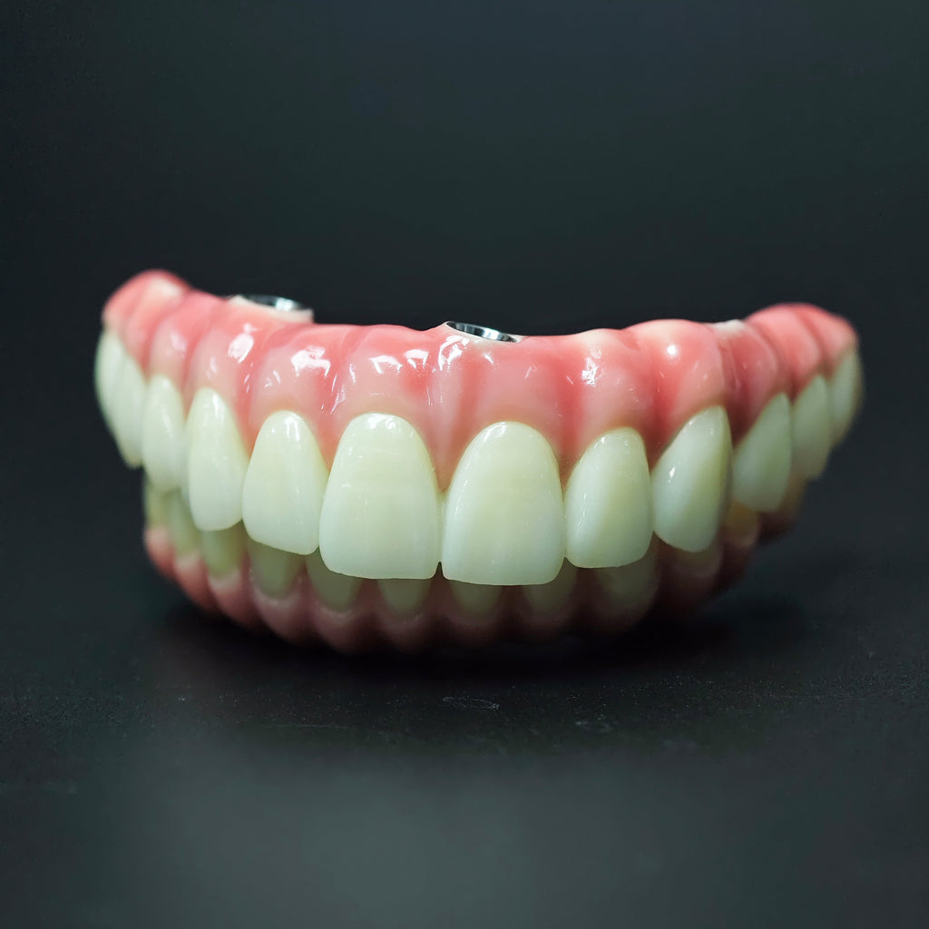 Zirconia-Enamel Hybrid Malo Bridge