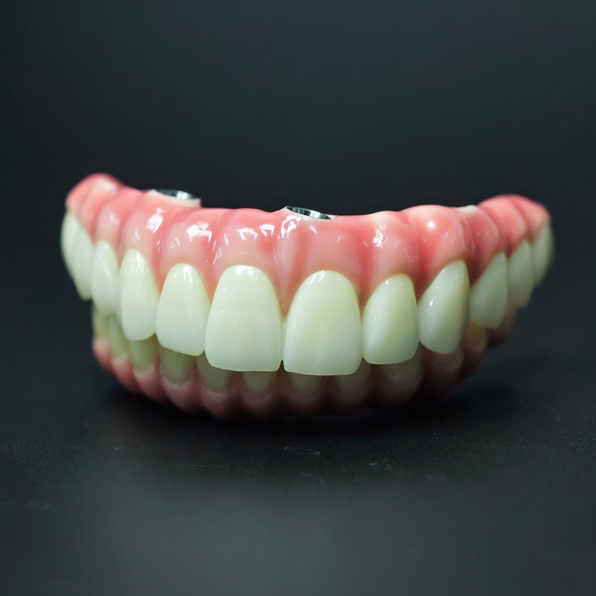 Zirconia-Enamel Hybrid Malo Bridge