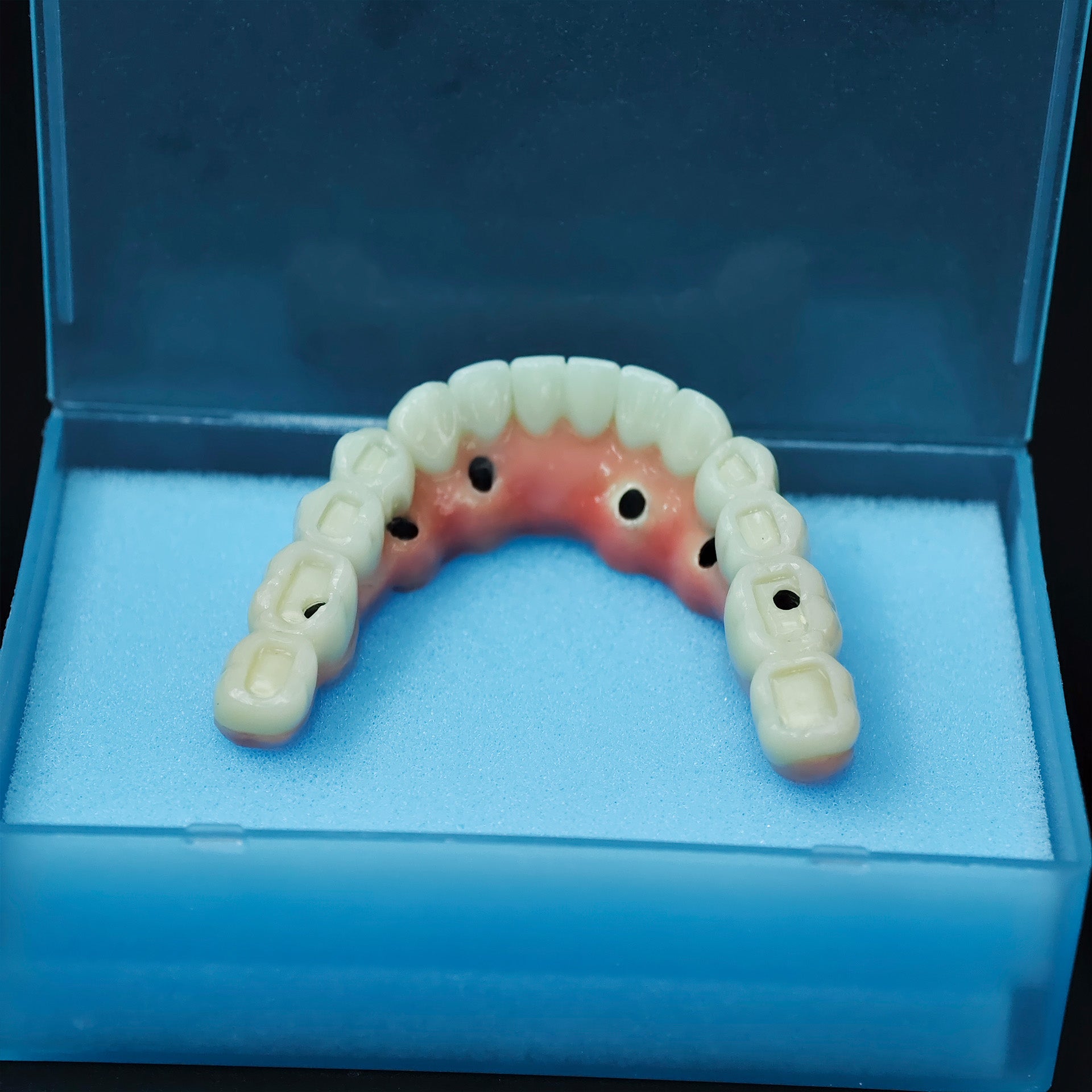 Zirconia-Enamel Hybrid Malo Bridge