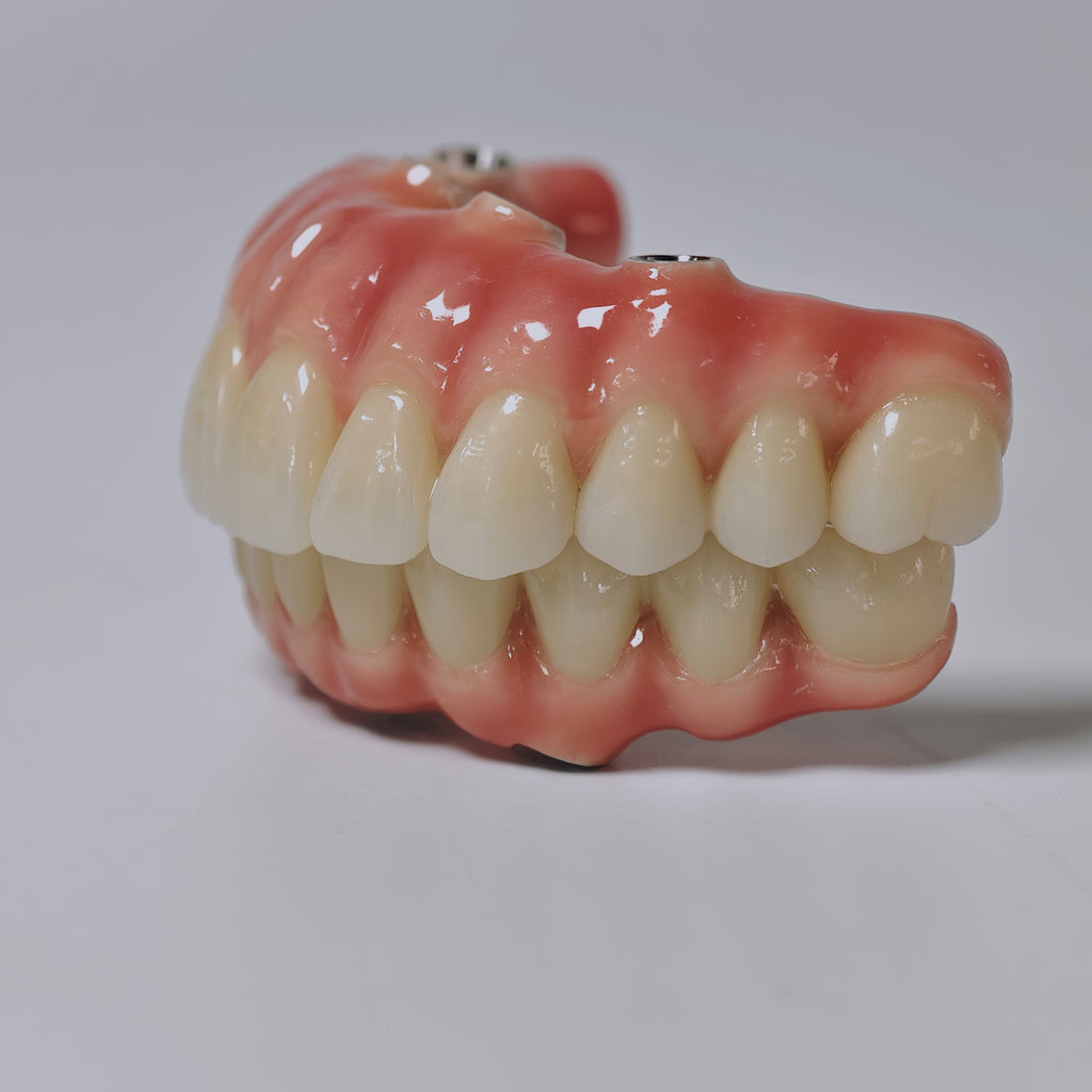 Zirconia-Enamel Hybrid Malo Bridge