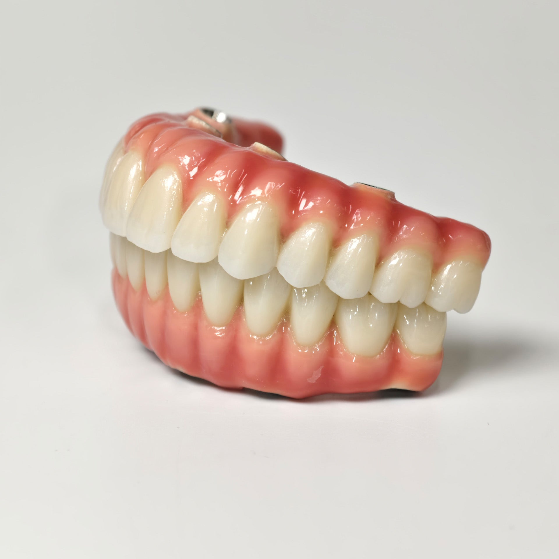 Zirconia-Enamel Hybrid Malo Bridge