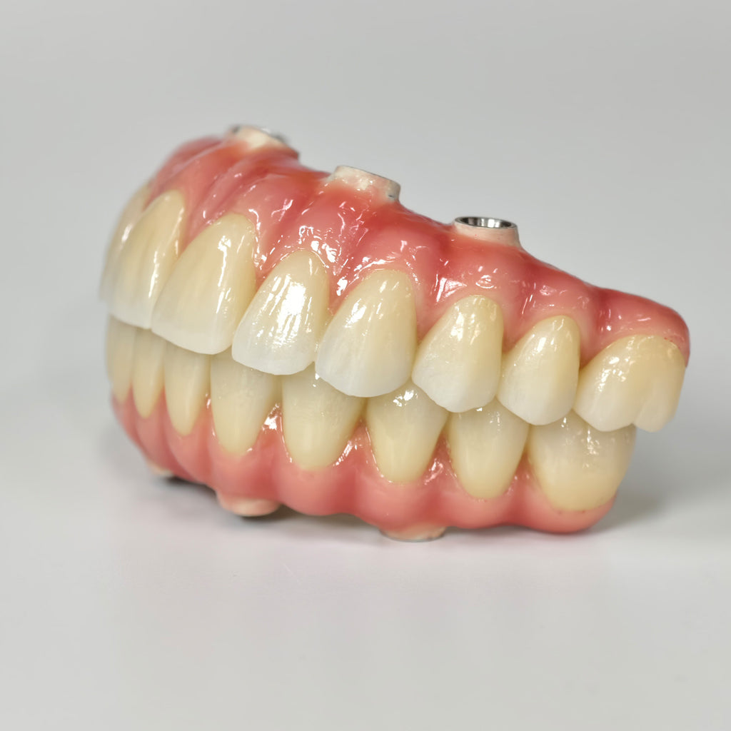Zirconia-Enamel Hybrid Malo Bridge