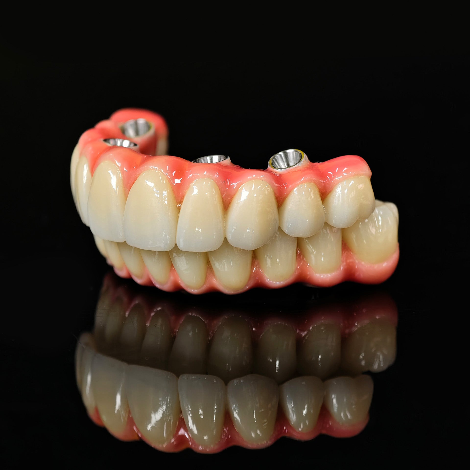 Zirconia-Enamel Hybrid Malo Bridge