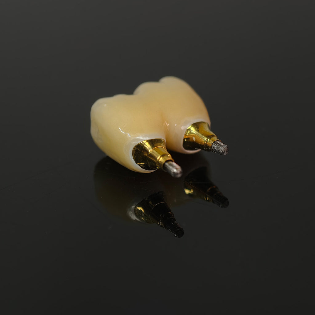 Zirconia Bridge With Screw Retained