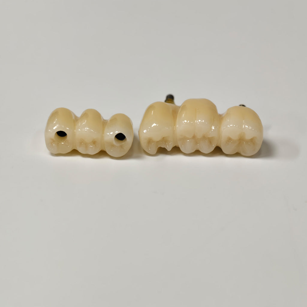 Zirconia Bridges With Screw Retained