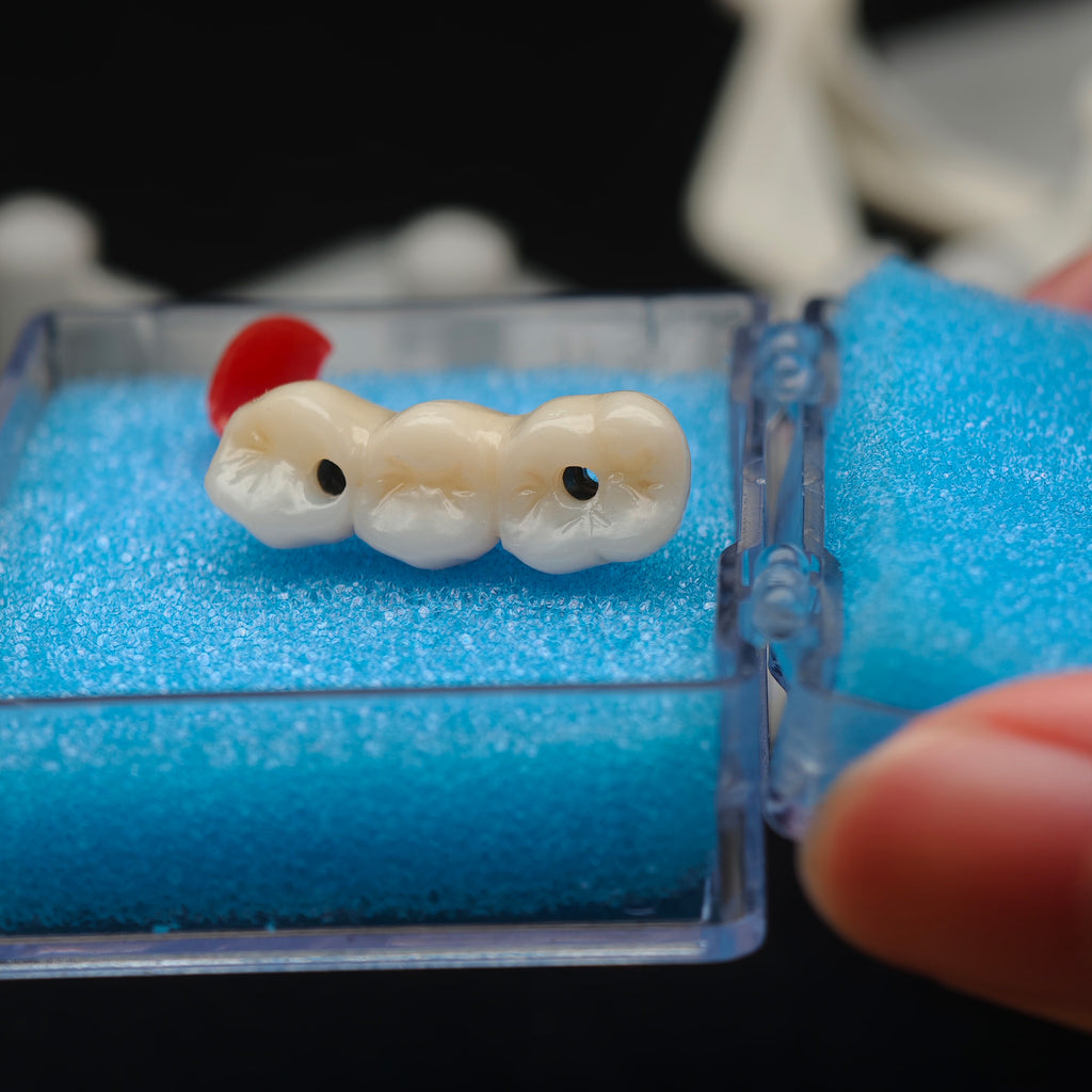 Zirconia Bridge With Ti-Base Screw Retained