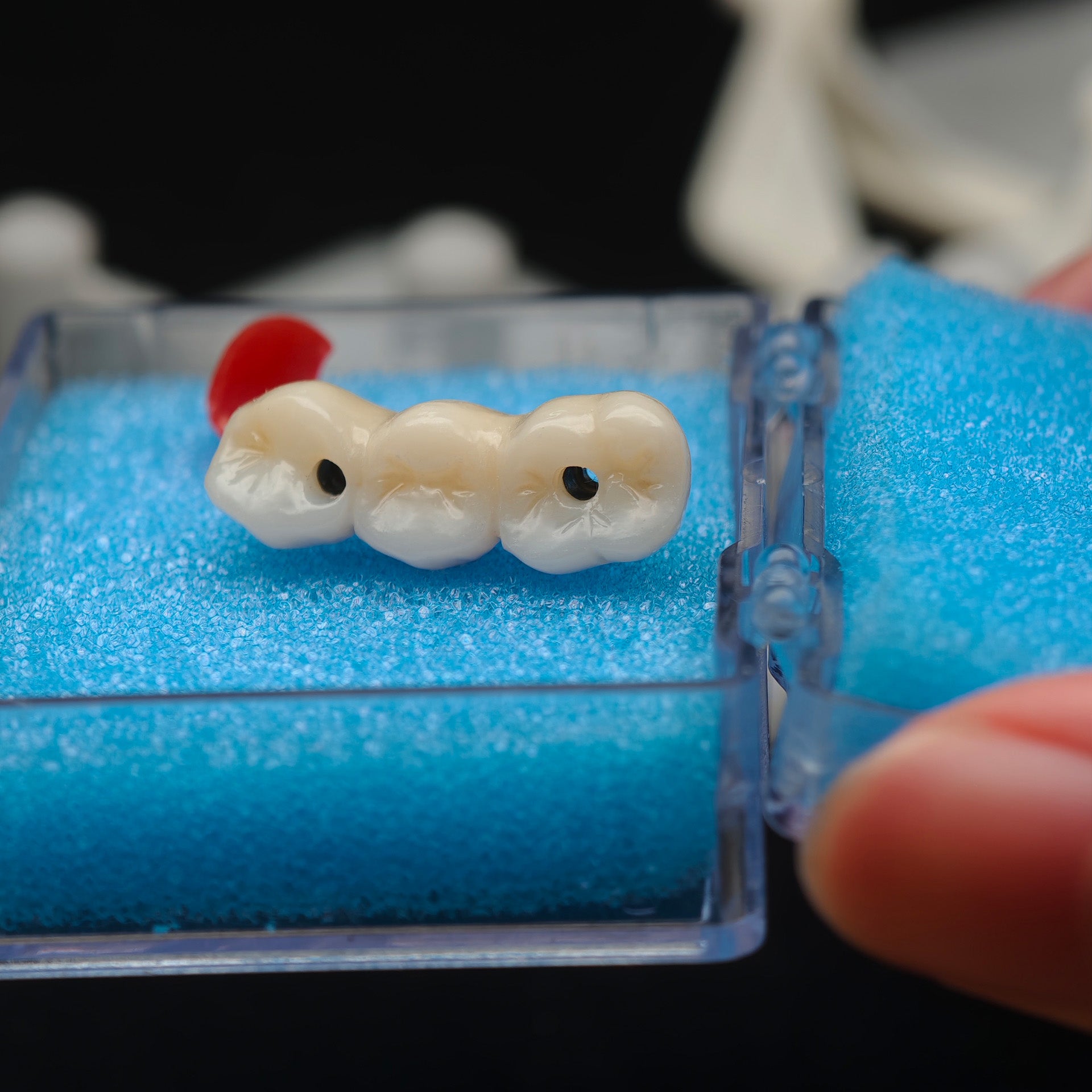 Zirconia Bridge With Ti-Base Screw Retained