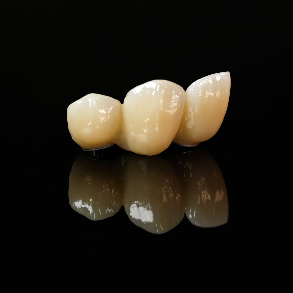 Zirconia Bridge With Ti-Base Screw Retained