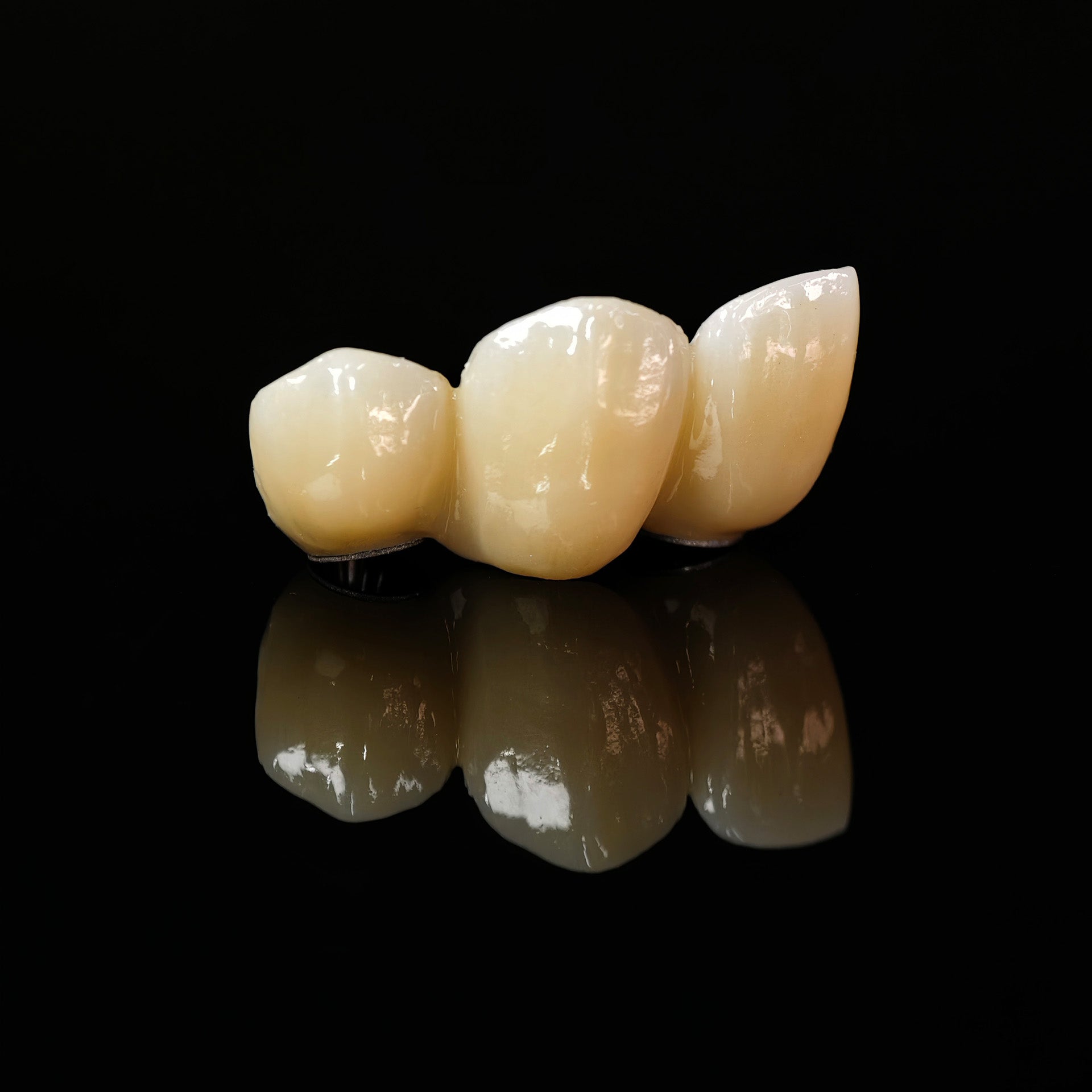 Zirconia Bridge With Ti-Base Screw Retained