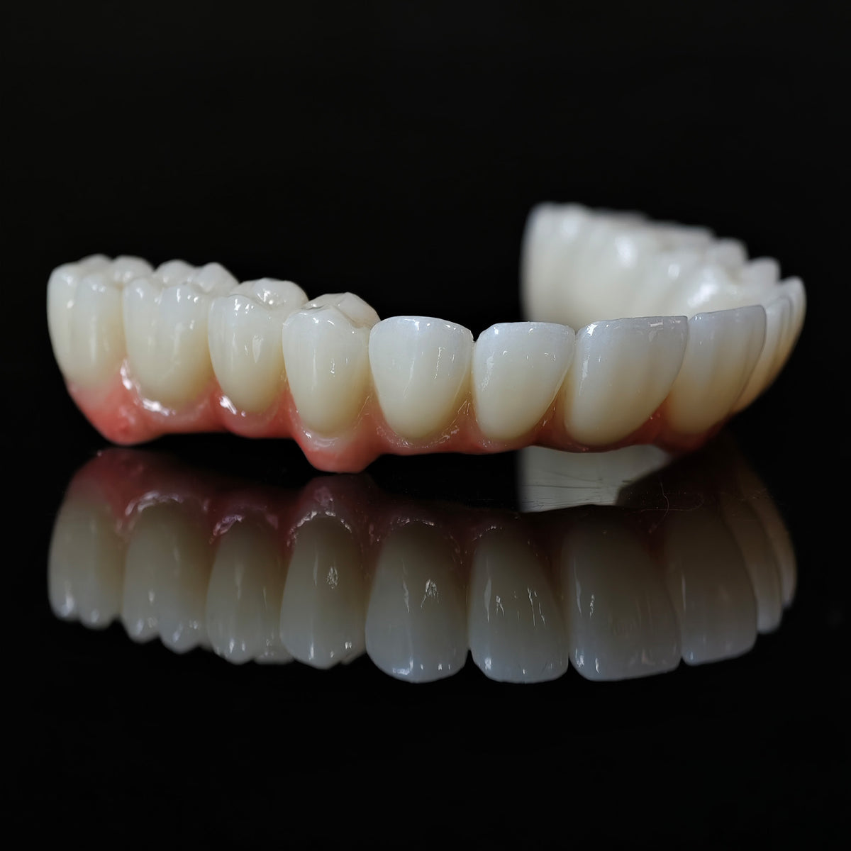Zirconia Bridge With Cement Retained