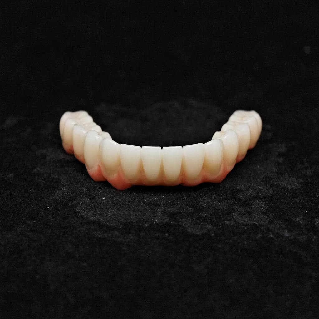 Zirconia Bridge With Cement Retained