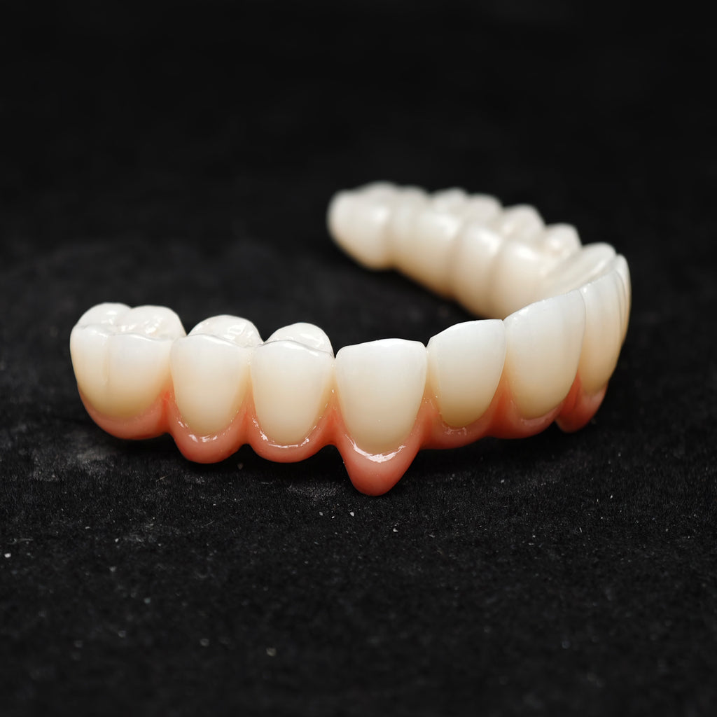 Zirconia Bridge With Cement Retained