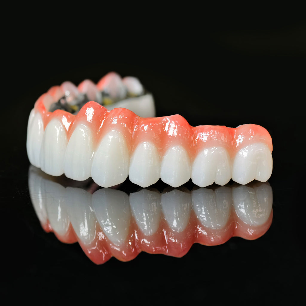 Zirconia Bridge With Cement Retained And Titanium Bar