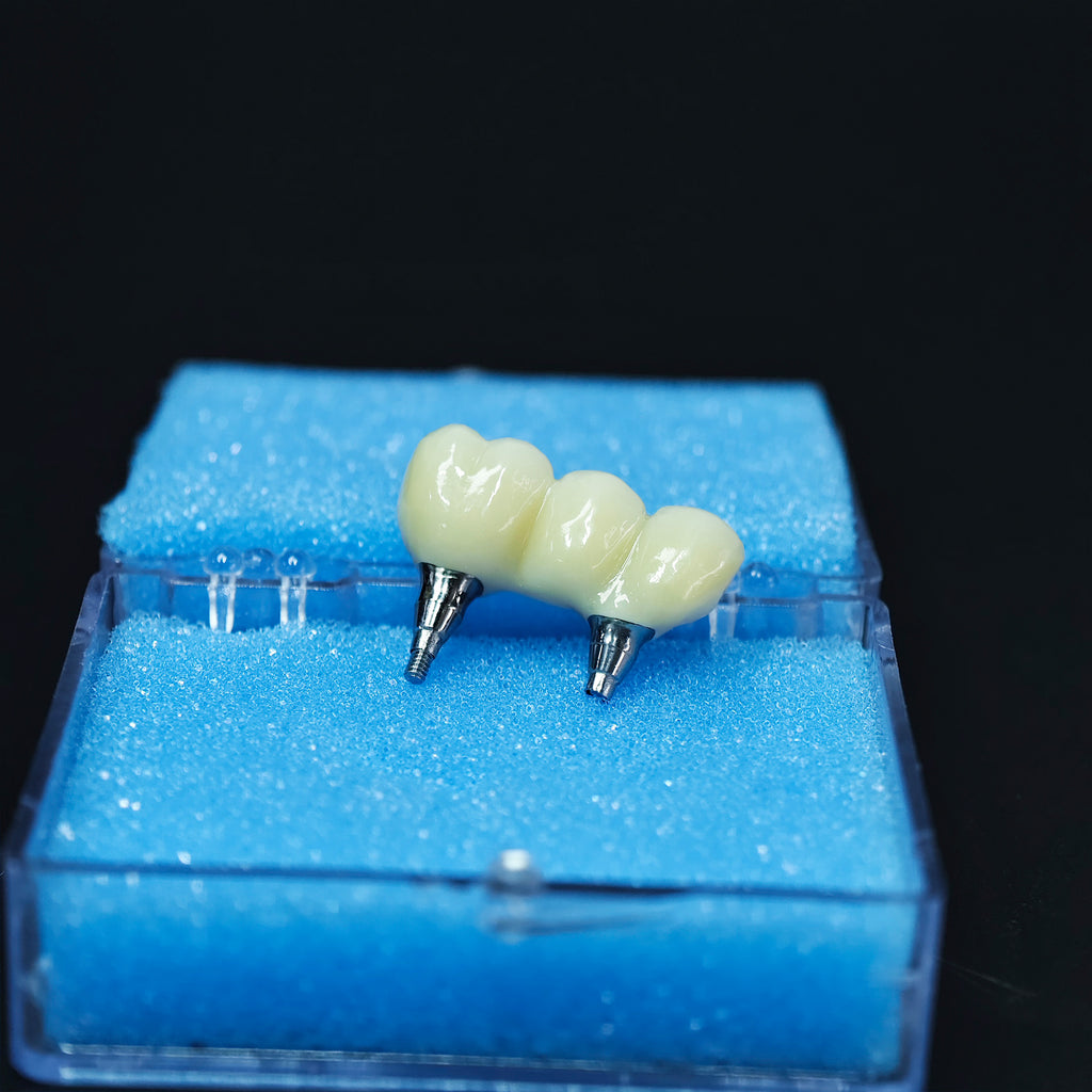 Zirconia Bridge With Screw Retained