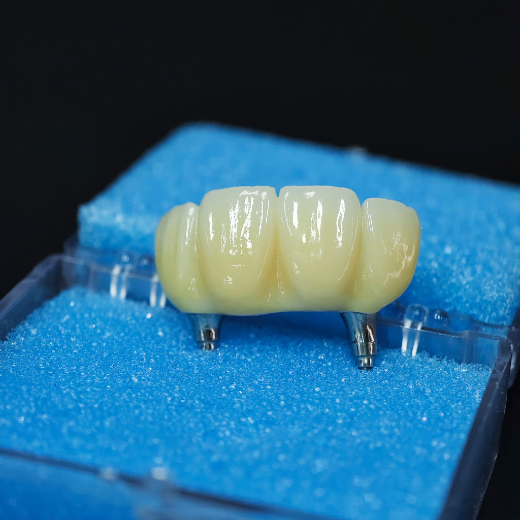 Zirconia Bridge With Screw Retained