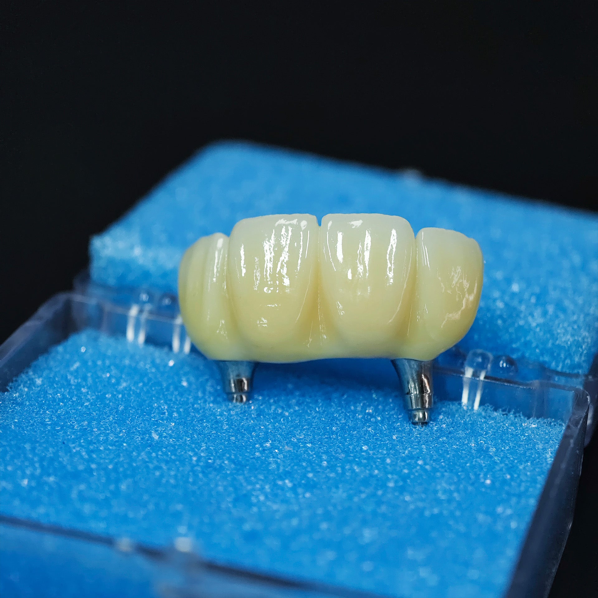 Zirconia Bridge With Screw Retained