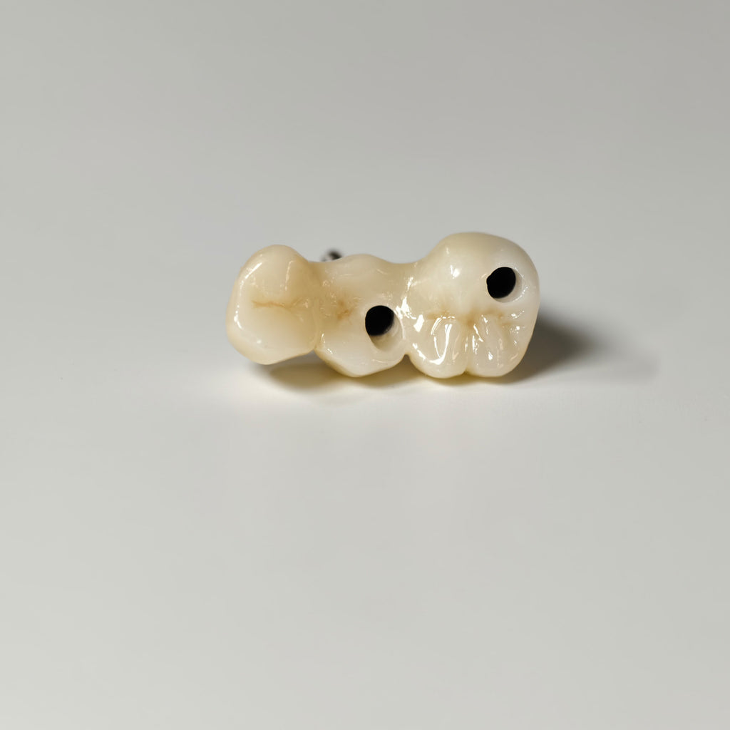 Zirconia Bridgewith Screw Retained